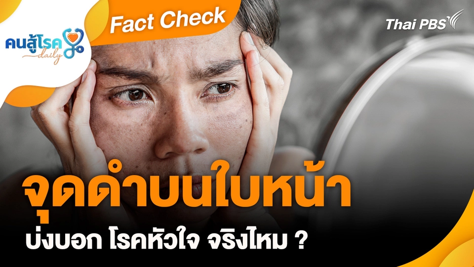 Fact Check : จุดดำบนใบหน้า บ่งบอก โรคหัวใจ ?