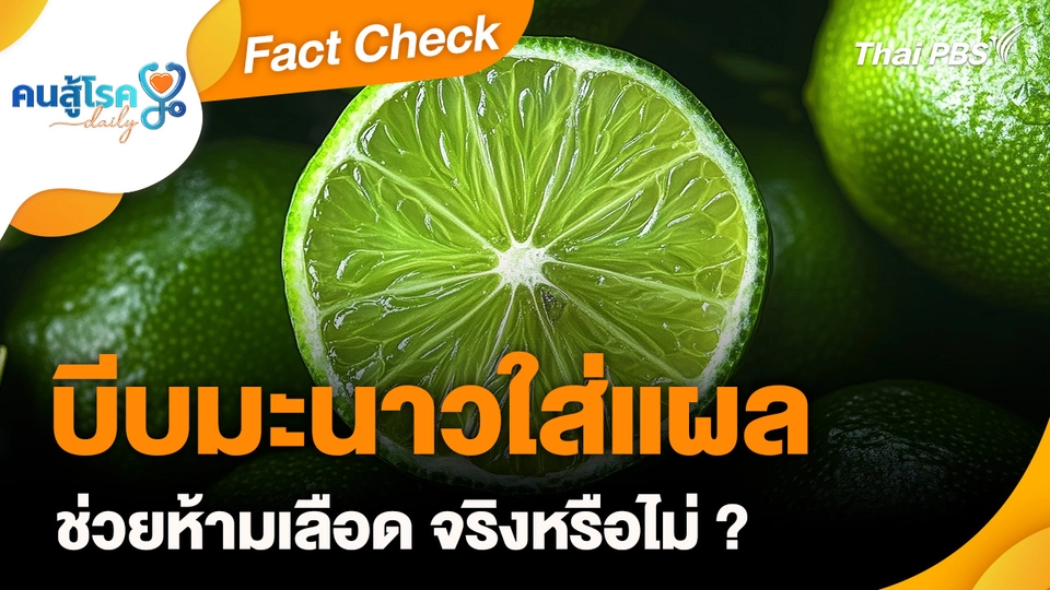 Fact Check : บีบมะนาวใส่แผล ช่วยห้ามเลือด จริงหรือไม่ ?