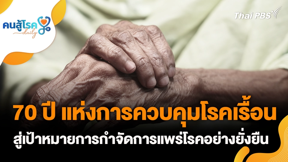 70 ปี แห่งการควบคุมโรคเรื้อน สู่เป้าหมายการกำจัดการแพร่โรคอย่างยั่งยืน