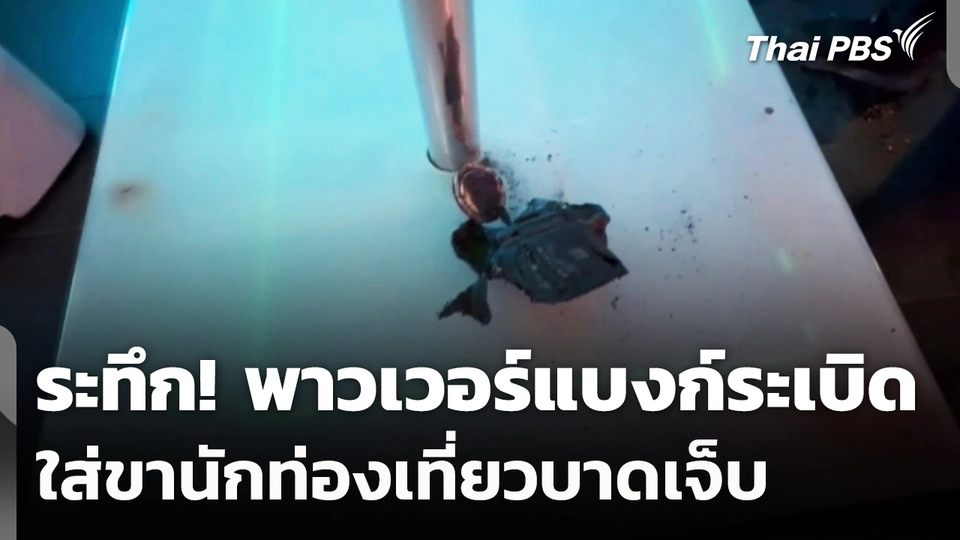 ระทึก! พาวเวอร์แบงก์ระเบิด ใส่ขานักท่องเที่ยวบาดเจ็บ