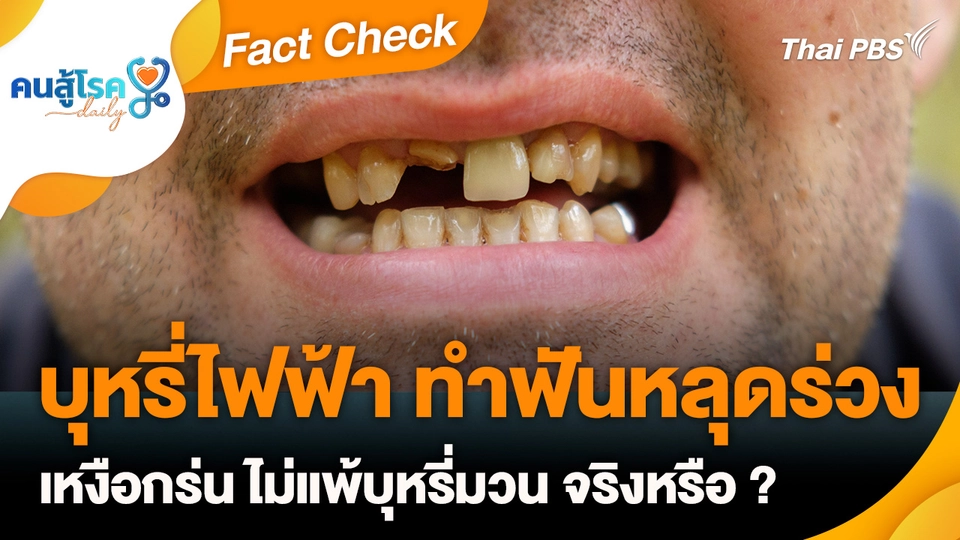 Fact Check :  บุหรี่ไฟฟ้า ทำฟันหลุดร่วง-เหงือกร่น ไม่แพ้บุหรี่มวน จริงหรือ ?