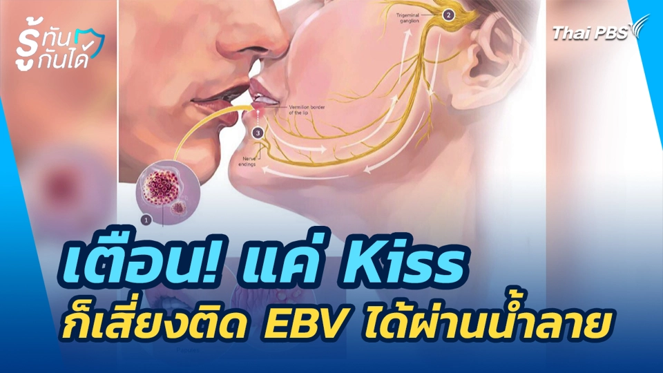 เตือน! แค่ Kiss ก็เสี่ยงติด ก็เสี่ยงติด EBV ได้ผ่านน้ำลาย