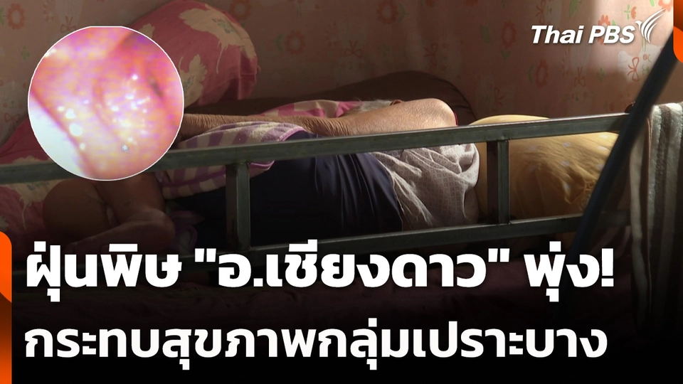 ฝุ่นพิษ "อ.เชียงดาว" พุ่ง! กระทบสุขภาพกลุ่มเปราะบาง