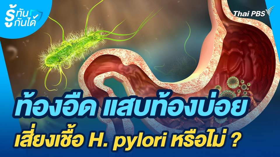 รู้ทันกันได้ : ท้องอืด แสบท้องบ่อย เสี่ยงเชื้อ H. pylori หรือไม่ ?
