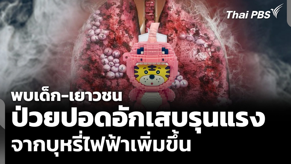 แพทย์พบเด็ก-เยาวชน ป่วยปอดอักเสบรุนแรงจากบุหรี่ไฟฟ้าเพิ่มขึ้น