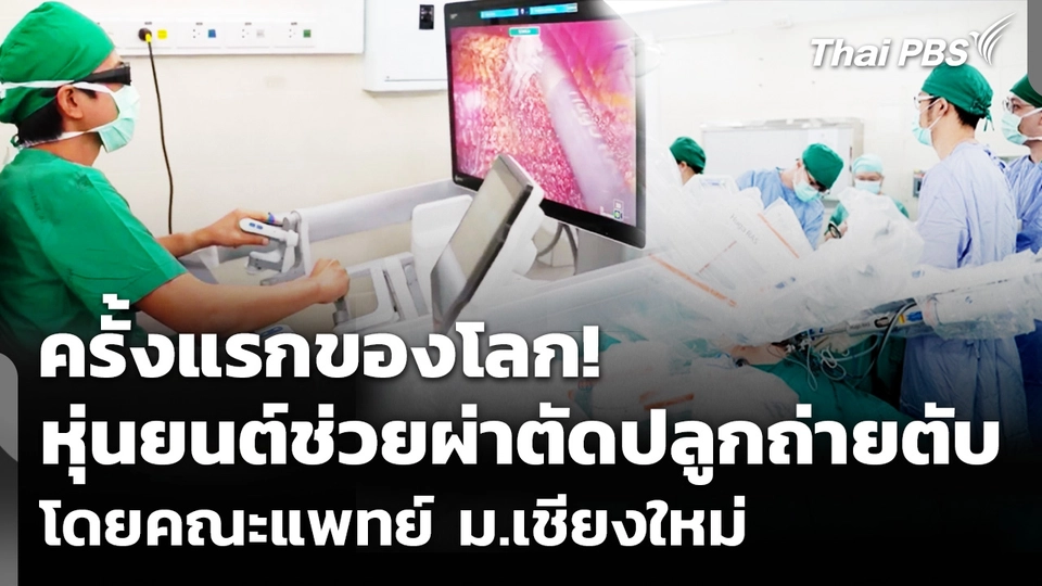 ครั้งแรกของโลก! คณะแพทย์ ม.เชียงใหม่ ใช้หุ่นยนต์ช่วยผ่าตัดปลูกถ่ายตับ