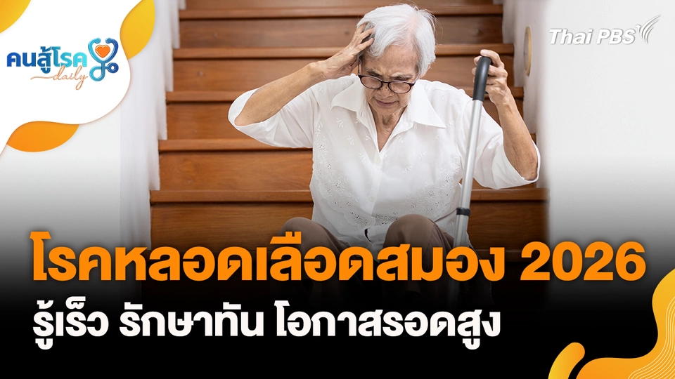 โรคหลอดเลือดสมอง, จิบน้ำขิงร้อน บรรเทาไมเกรน จริงหรือ ?