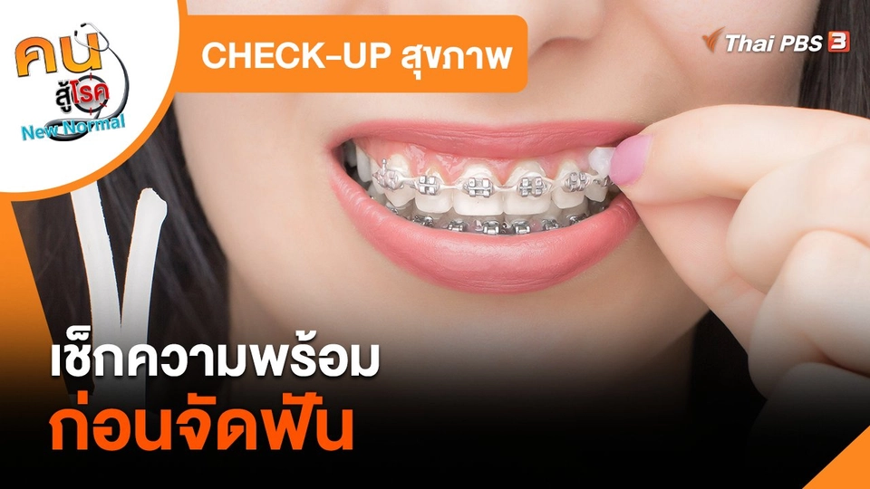 CHECK-UP สุขภาพ : เช็กความพร้อมก่อนจัดฟัน