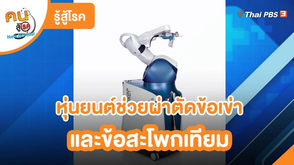 รู้สู้โรค : หุ่นยนต์ช่วยผ่าตัดข้อเข่าและข้อสะโพกเทียม