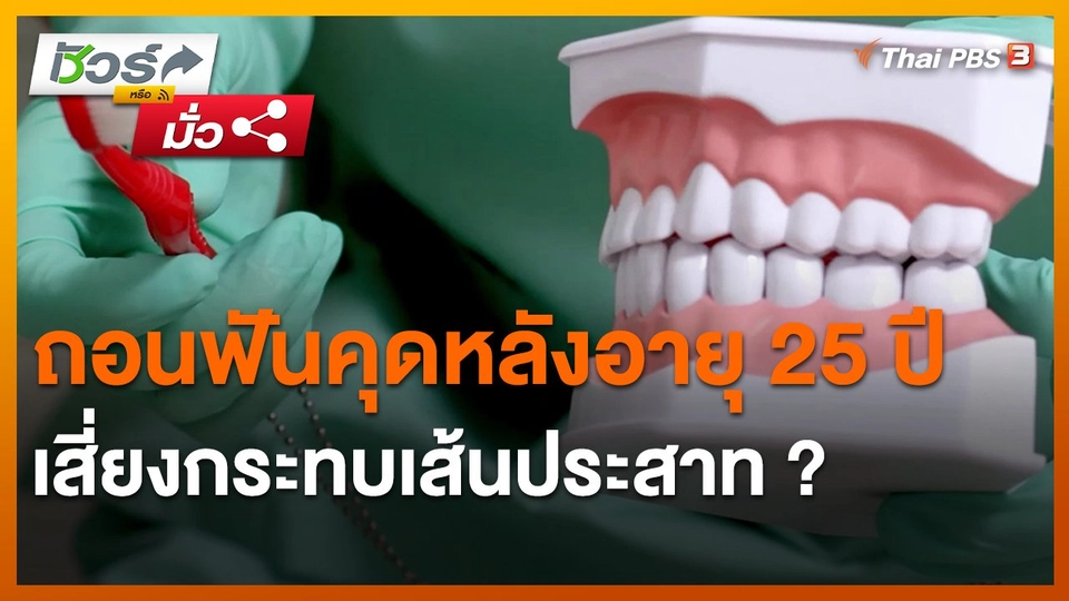​ชัวร์หรือมั่ว : ถอนฟันคุดหลังอายุ 25 ปี เสี่ยงกระทบเส้นประสาท ?