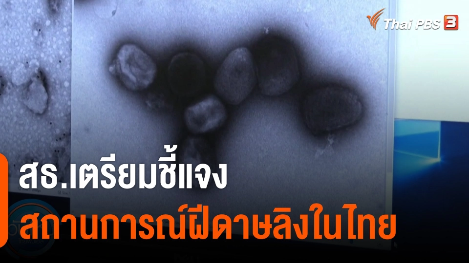สธ.เตรียมชี้แจงสถานการณ์ฝีดาษลิงในไทย