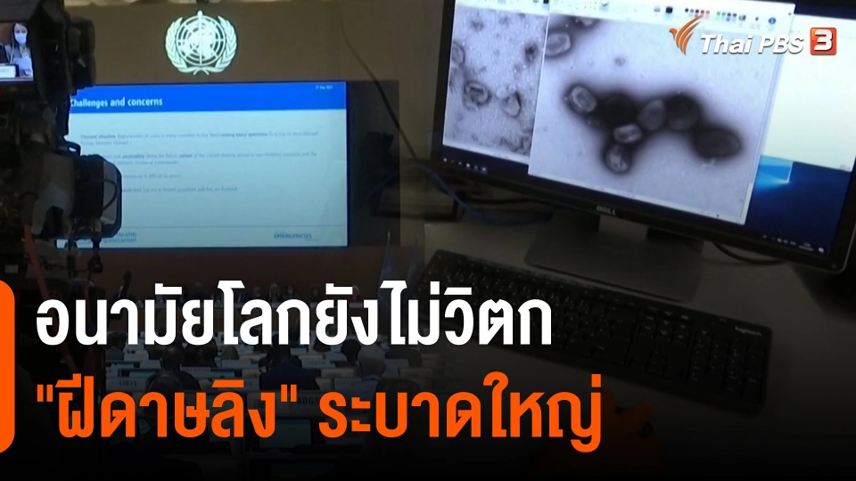 อนามัยโลกยังไม่วิตก "ฝีดาษลิง" ระบาดใหญ่