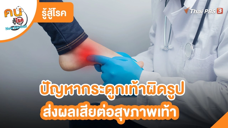 รู้สู้โรค : ปัญหากระดูกเท้าผิดรูป ส่งผลเสียต่อสุขภาพเท้า