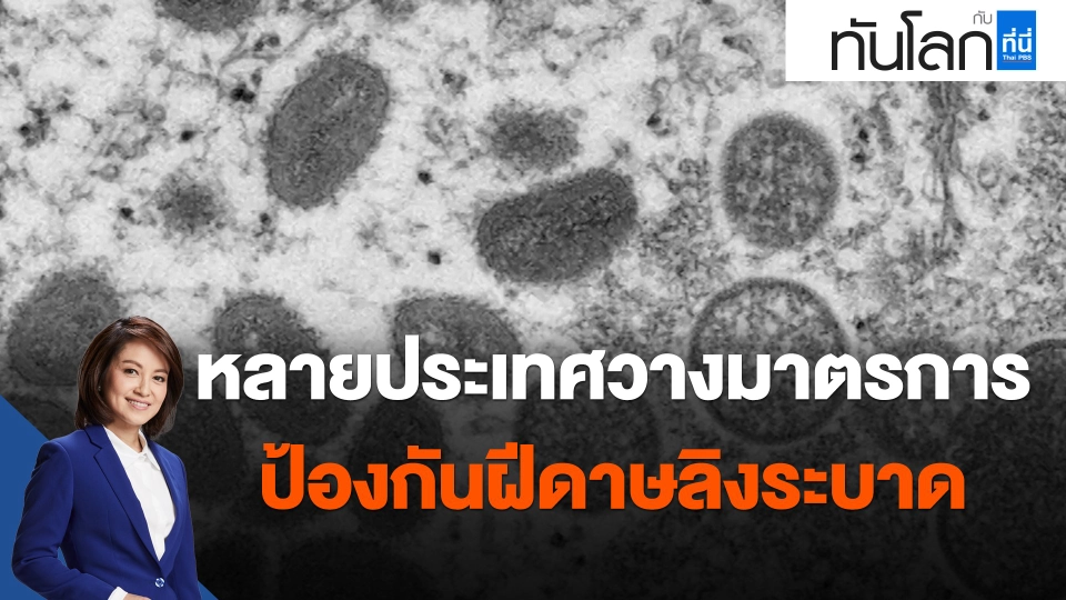​หลายประเทศวางมาตรการป้องกันฝีดาษลิงระบาด