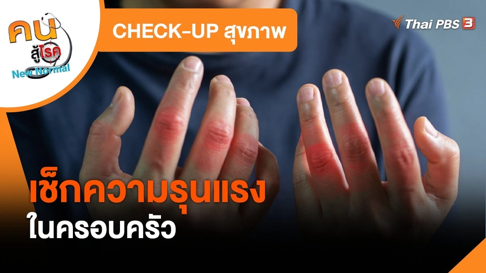 CHECK-UP สุขภาพ : เช็กความรุนแรงในครอบครัว