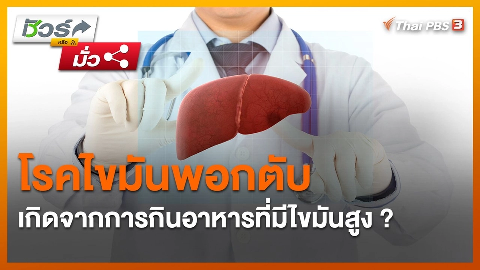 ​ชัวร์หรือมั่ว : โรคไขมันพอกตับ เกิดจากการกินอาหารที่มีไขมันสูง ?