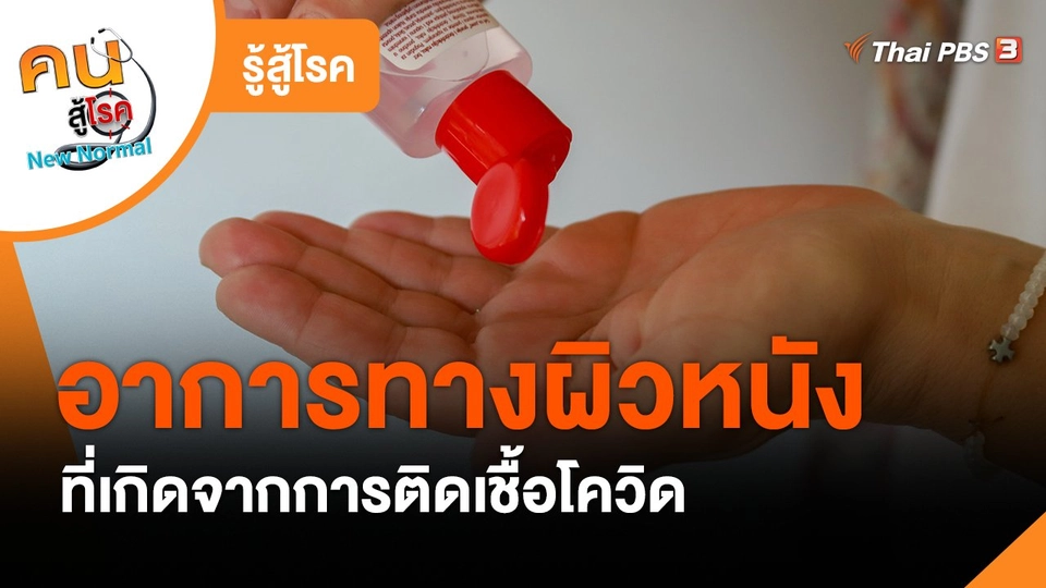 รู้สู้โรค : อาการทางผิวหนังที่เกิดจากการติดเชื้อโควิด