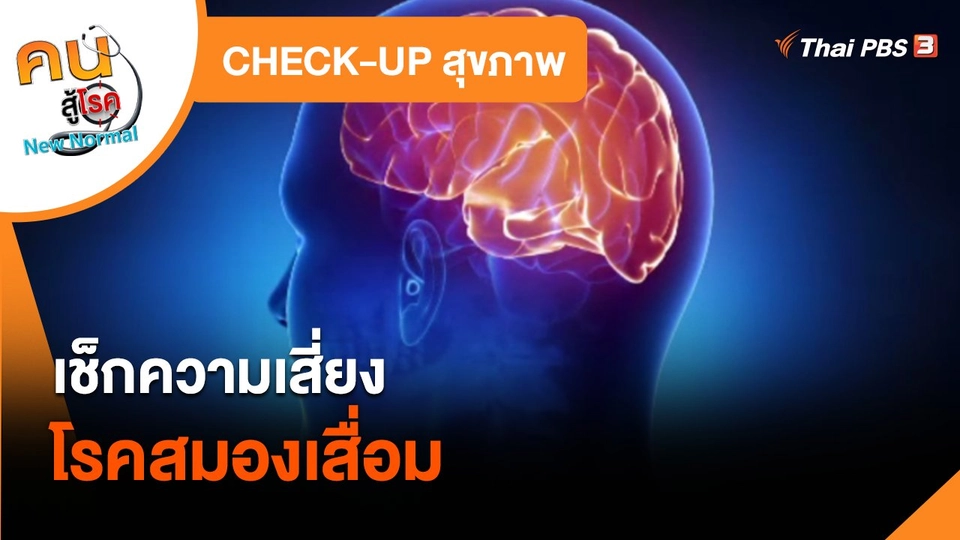 ​CHECK-UP สุขภาพ : เช็กความเสี่ยงโรคสมองเสื่อม