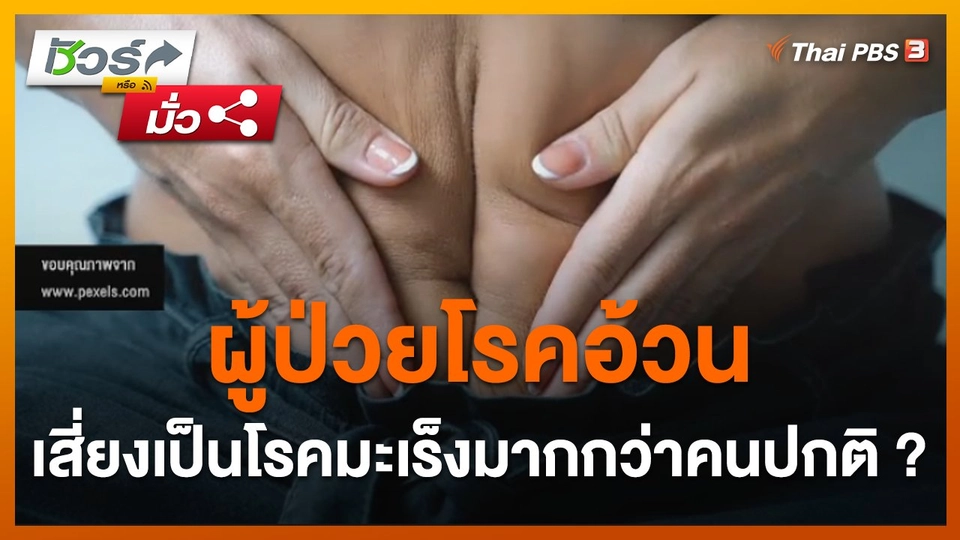 ชัวร์หรือมั่ว : ผู้ป่วยโรคอ้วน เสี่ยงเป็นโรคมะเร็งมากกว่าคนปกติ ?