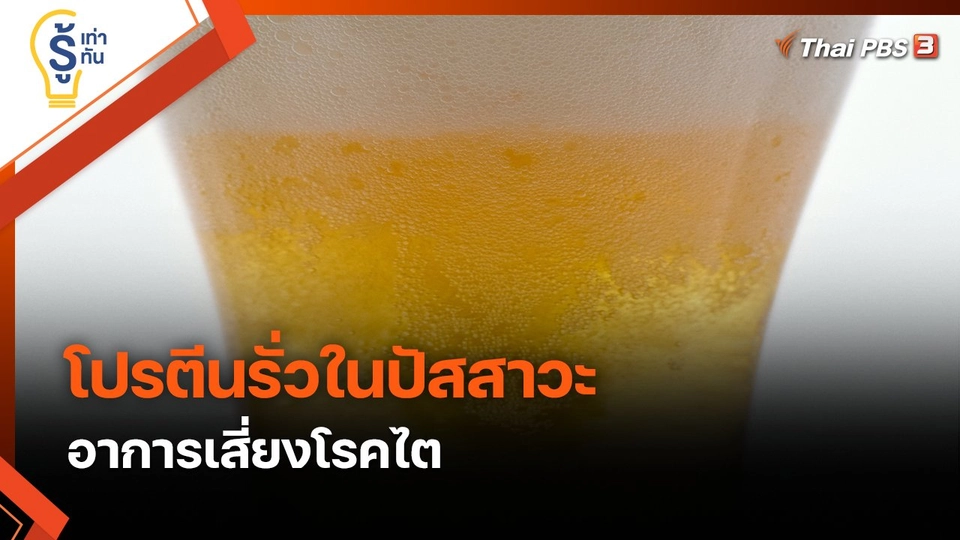 รู้เท่ารู้ทัน : "โปรตีนรั่วในปัสสาวะ" อาการเสี่ยงโรคไต