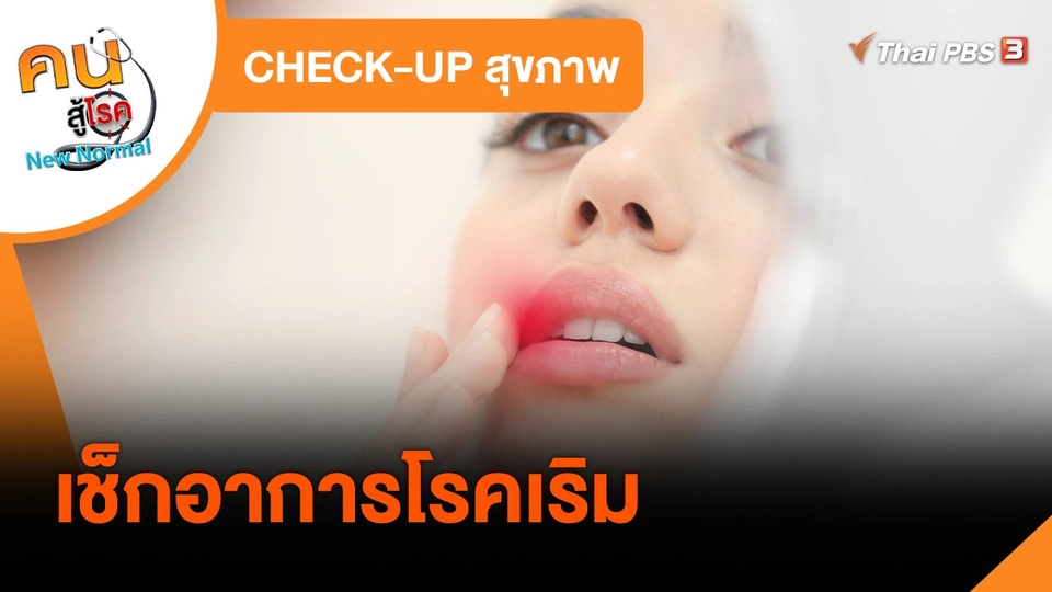 ​CHECK-UP สุขภาพ : เช็กอาการโรคเริม