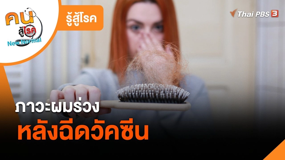 ​รู้สู้โรค : ภาวะผมร่วงหลังฉีดวัคซีน