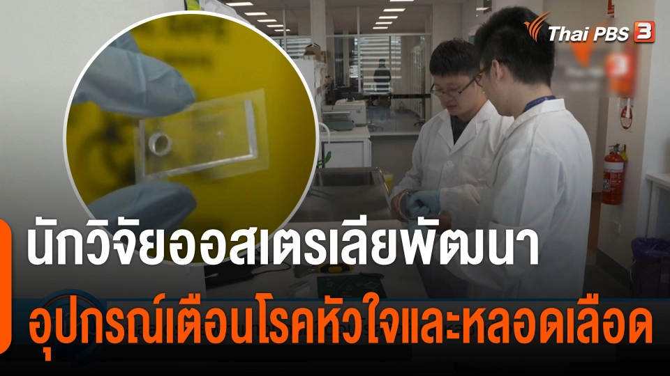 นักวิจัยออสเตรเลีย พัฒนาอุปกรณ์เตือนโรคหัวใจและหลอด