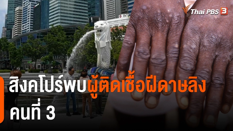 สิงคโปร์พบผู้ติดเชื้อฝีดาษลิงคนที่ 3