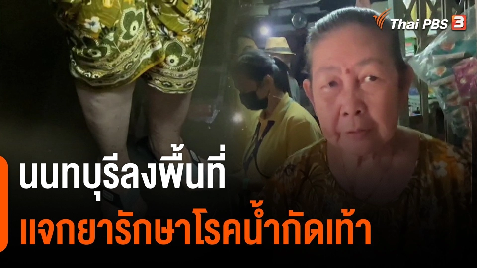 นนทบุรีลงพื้นที่เเจกยารักษาโรคน้ำกัดเท้า