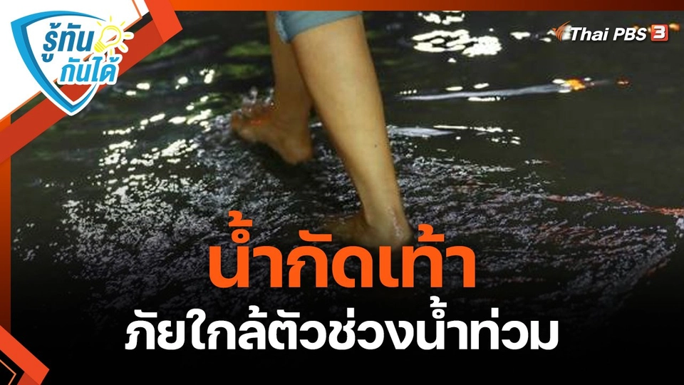 ​รู้ทันกันได้ : "น้ำกัดเท้า" ภัยใกล้ตัวช่วงน้ำท่วม