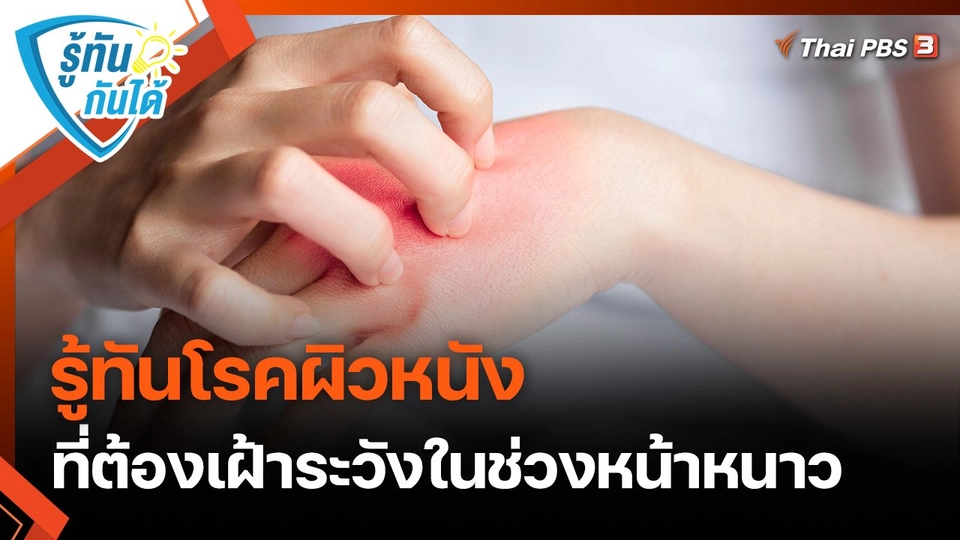 รู้ทันกันได้ : รู้ทันโรคผิวหนัง ที่ต้องเฝ้าระวังในช่วงหน้าหนาว