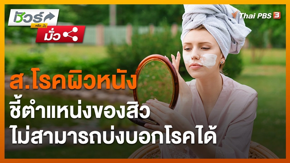 ​ชัวร์หรือมั่ว : ส.โรคผิวหนัง ชี้ตำแหน่งของสิวไม่สามารถบ่งบอกโรคได้
