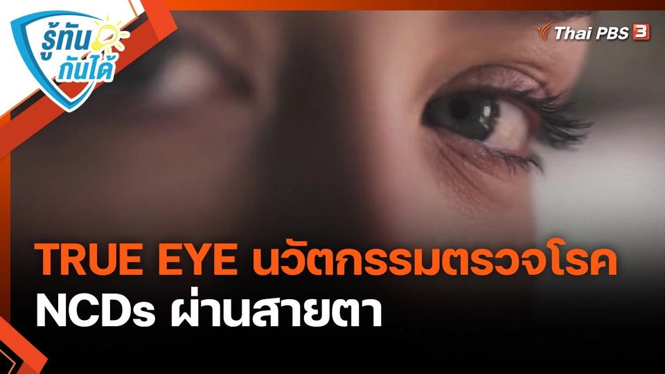 รู้ทันกันได้ : TRUE EYE นวัตกรรมตรวจโรค NCDs ผ่านสายตา