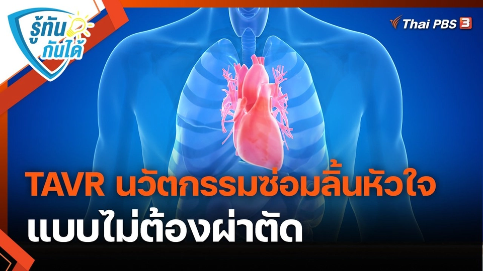 ​รู้ทันกันได้ : TAVR นวัตกรรมซ่อมลิ้นหัวใจ แบบไม่ต้องผ่าตัด