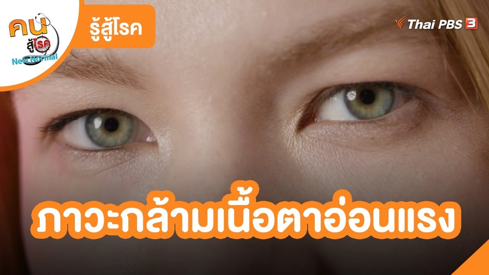 รู้สู้โรค : ภาวะกล้ามเนื้อตาอ่อนแรง