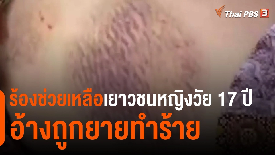 ​ร้องช่วยเหลือเยาวชนหญิงวัย17 ปี อ้างถูกยายทำร้าย
