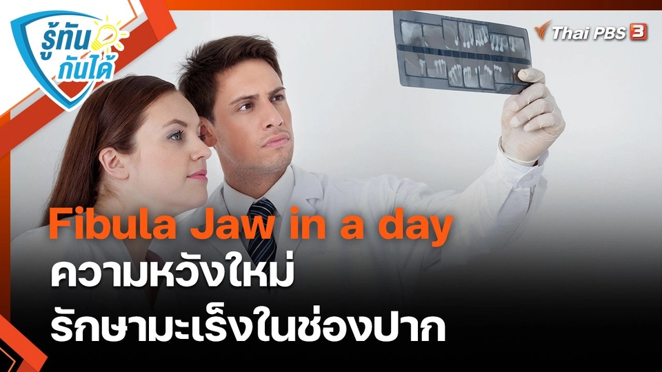 ​รู้ทันกันได้ : Fibula Jaw in a day ความหวังใหม่รักษามะเร็งในช่องปาก