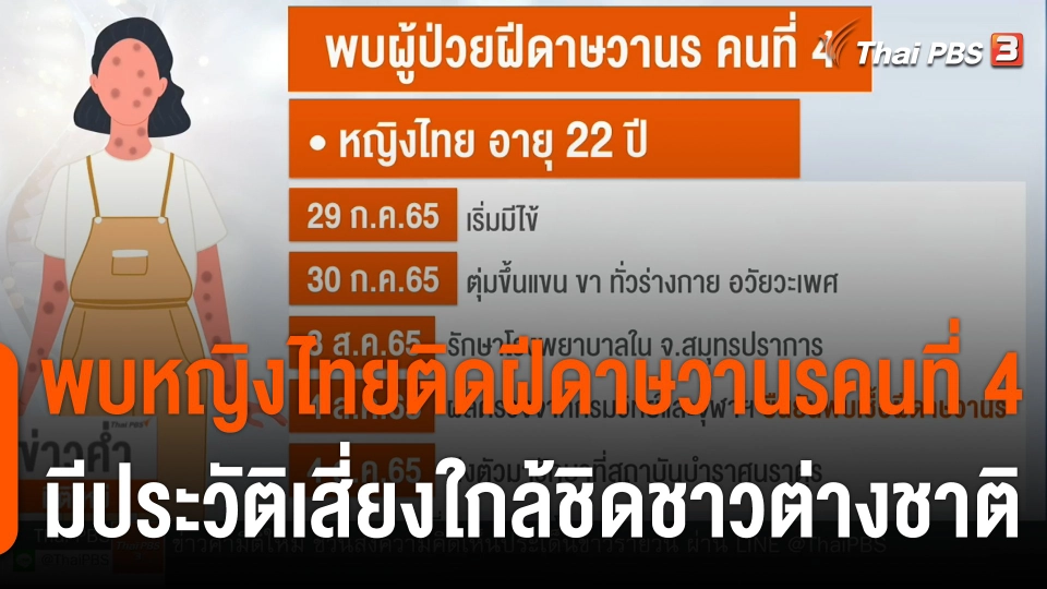 พบหญิงไทยติดฝีดาษวานรคนที่ 4 มีประวัติเสี่ยงใกล้ชิดชาวต่างชาติ