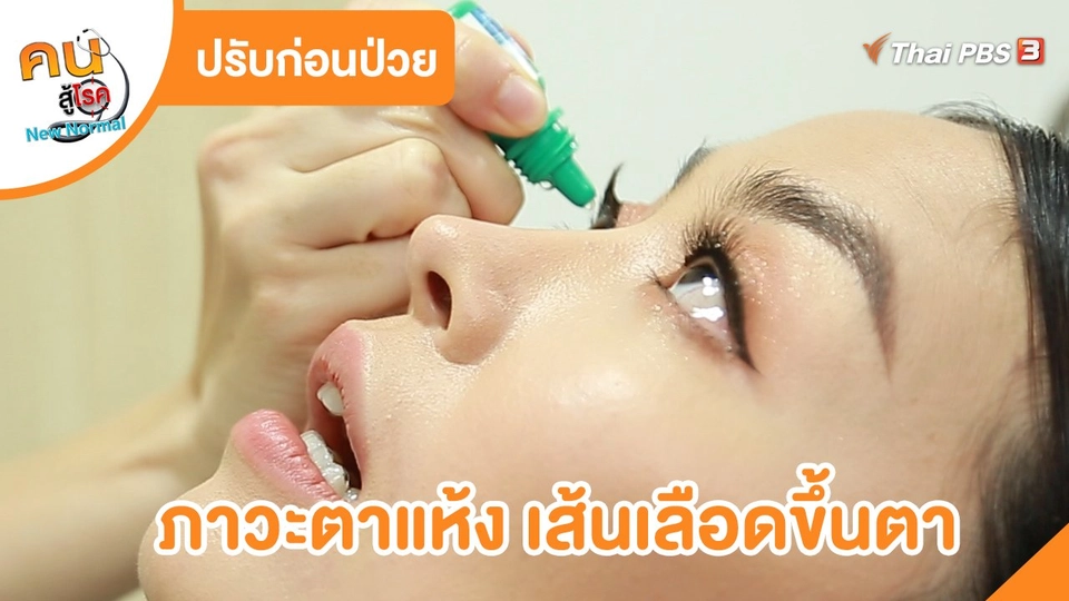 ปรับก่อนป่วย : ภาวะตาแห้ง เส้นเลือดขึ้นตา