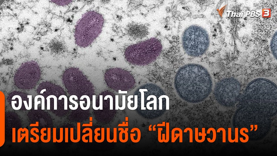 องค์การอนามัยโลก เตรียมเปลี่ยนชื่อ "ฝีดาษวานร"