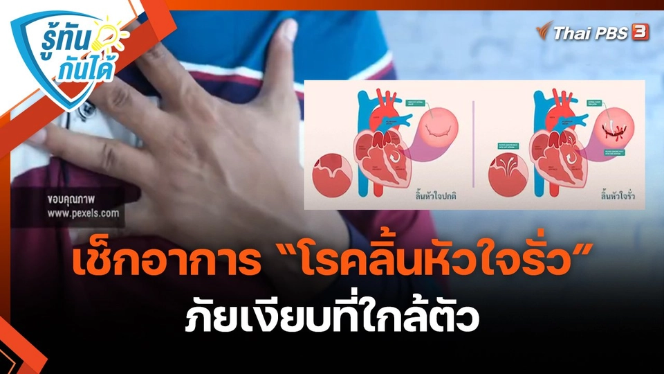 รู้ทันกันได้ : เช็กอาการ "โรคลิ้นหัวใจรั่ว" ภัยเงียบที่ใกล้ตัว