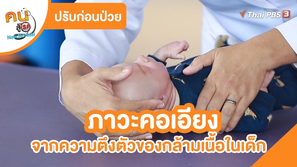 ​ปรับก่อนป่วย : ภาวะคอเอียงจากความตึงตัวของกล้ามเนื้อในเด็ก
