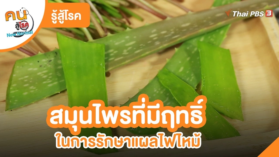 ​รู้สู้โรค : สมุนไพรที่มีฤทธิ์ในการรักษาแผลไฟไหม้