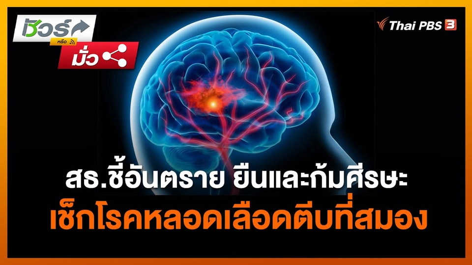 ชัวร์หรือมั่ว : สธ.ชี้อันตราย ยืนและก้มศีรษะเช็กโรคหลอดเลือดตีบที่สมอง