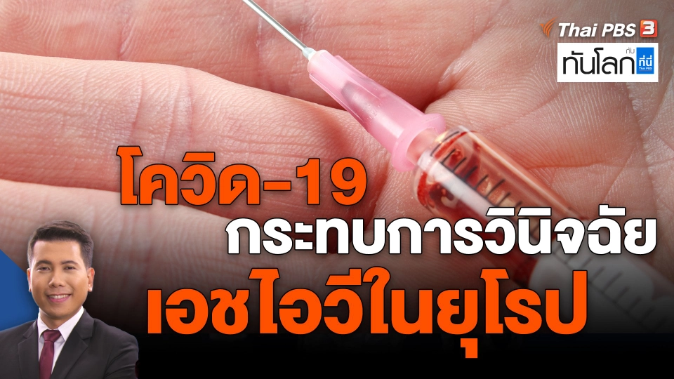 ​World roundup : โควิด-19 กระทบการวินิจฉัยเอชไอวีในยุโรป