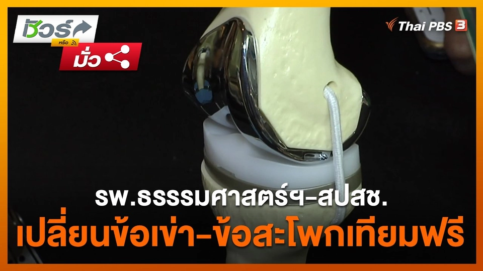 ชัวร์หรือมั่ว : รพ.ธรรรมศาสตร์ฯ - สปสช. เปลี่ยนข้อเข่า - ข้อสะโพกเทียมฟรี