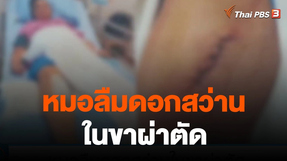 หมอลืมดอกสว่านในขาผ่าตัด