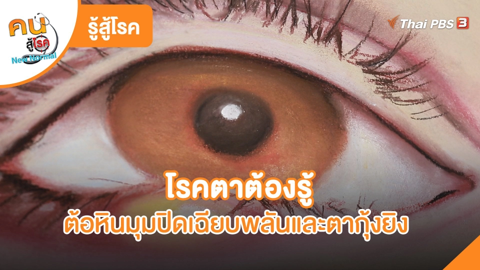โรคตาต้องรู้ ต้อหินมุมปิดเฉียบพลันและตากุ้งยิง