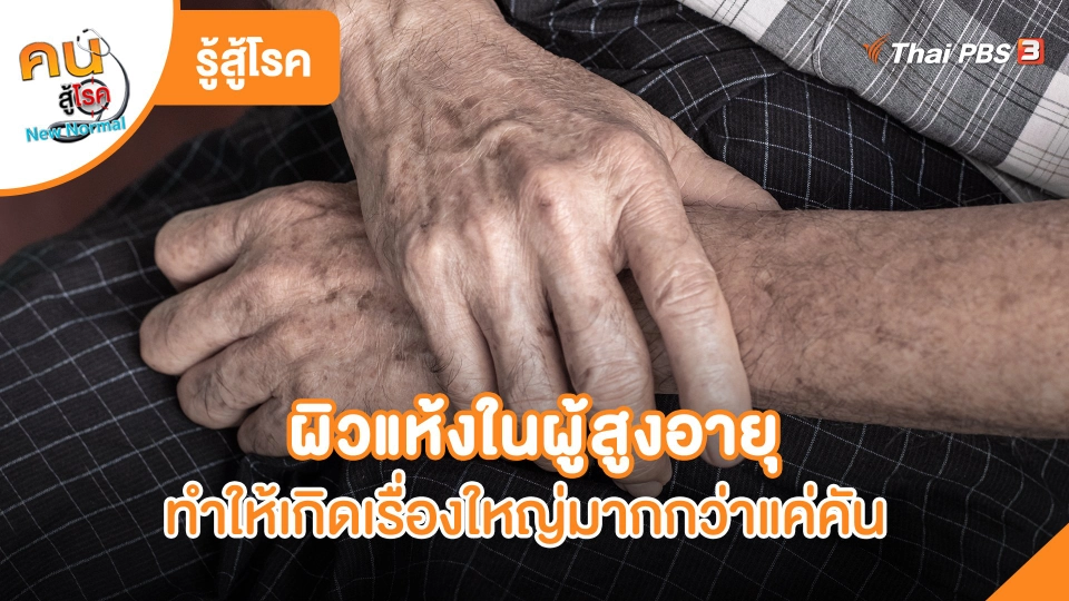 ผิวแห้งในผู้สูงอายุ ทำให้เกิดเรื่องใหญ่มากกว่าแค่คัน