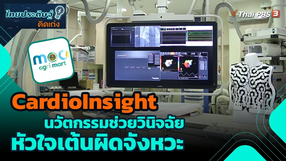 ​ไทยประดิษฐ์คิดเก่ง : CardioInsight นวัตกรรมช่วยวินิจฉัยหัวใจเต้นผิดจังหวะ